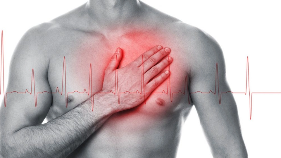 Cardiopatía coronaria