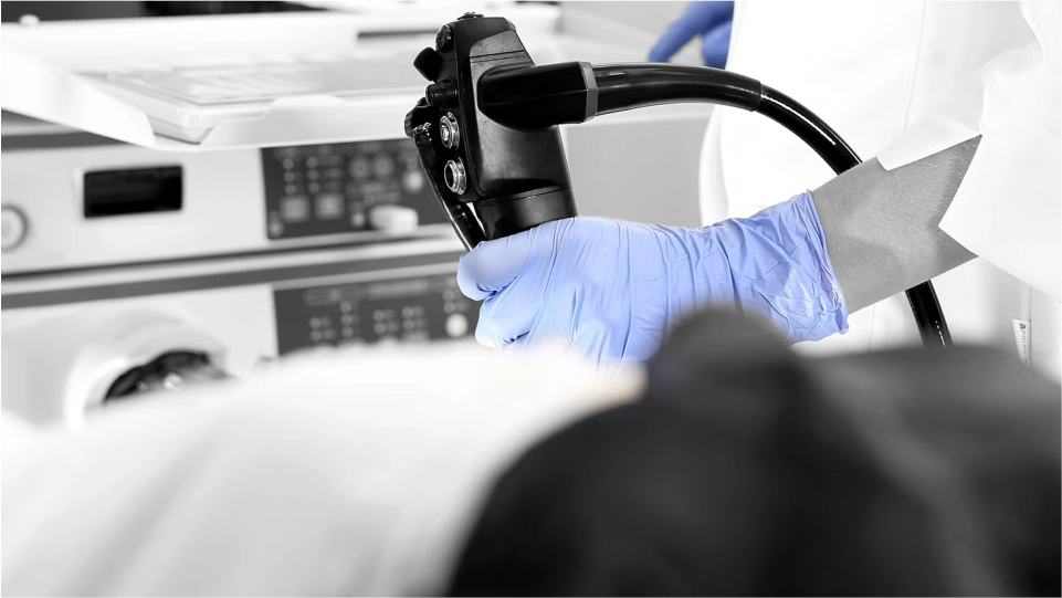 Colonoscopia izquierda