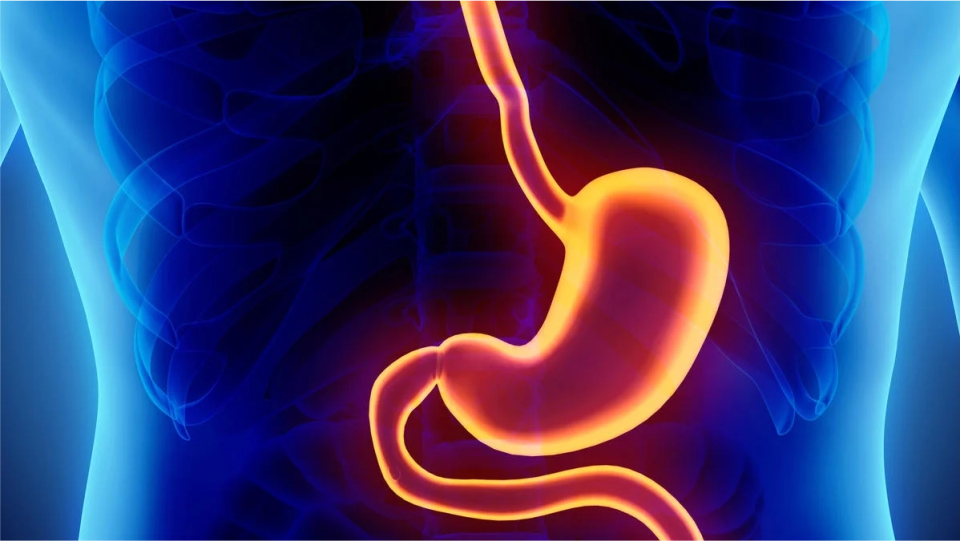 Polipeptomía en estomago