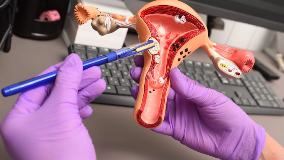 Cáncer ginecológico