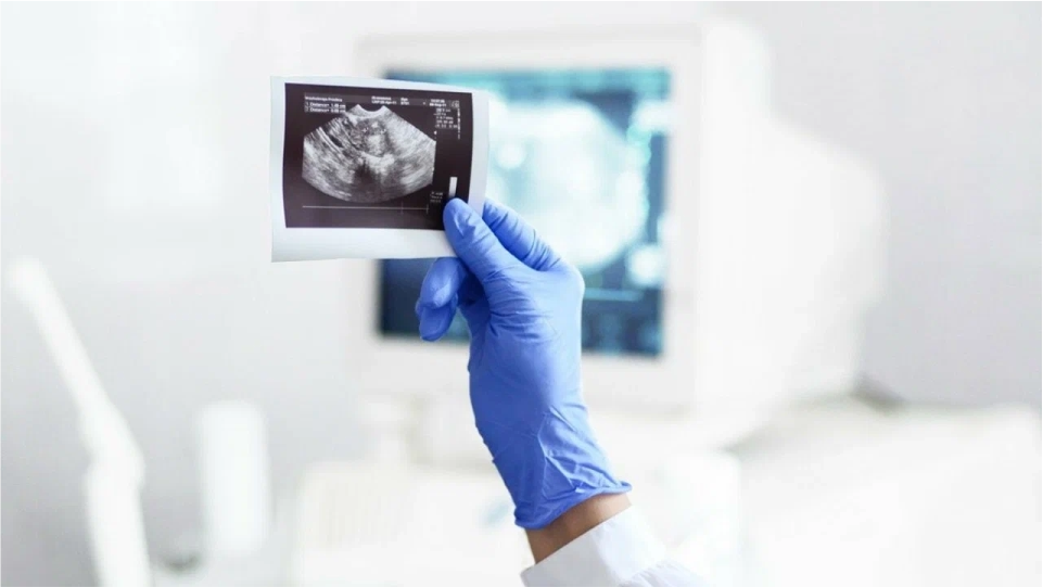Ecografía transvaginal