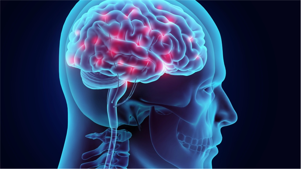 Epilepsia