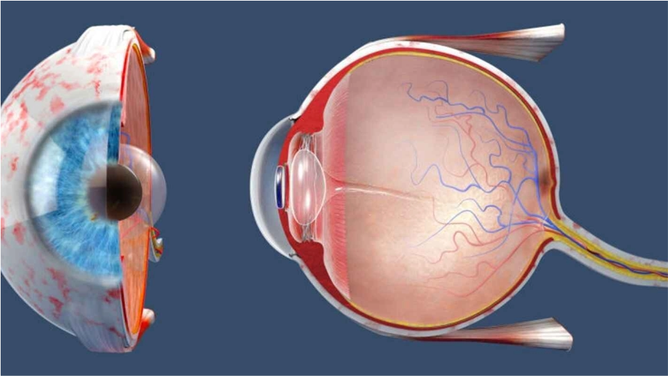 Cirugía de desprendimiento de retina