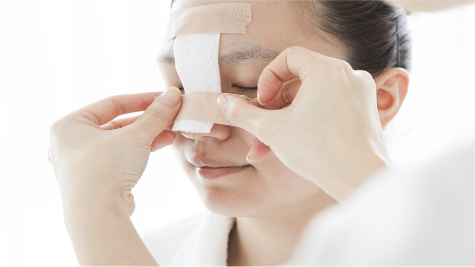 Fijación de fractura nasal