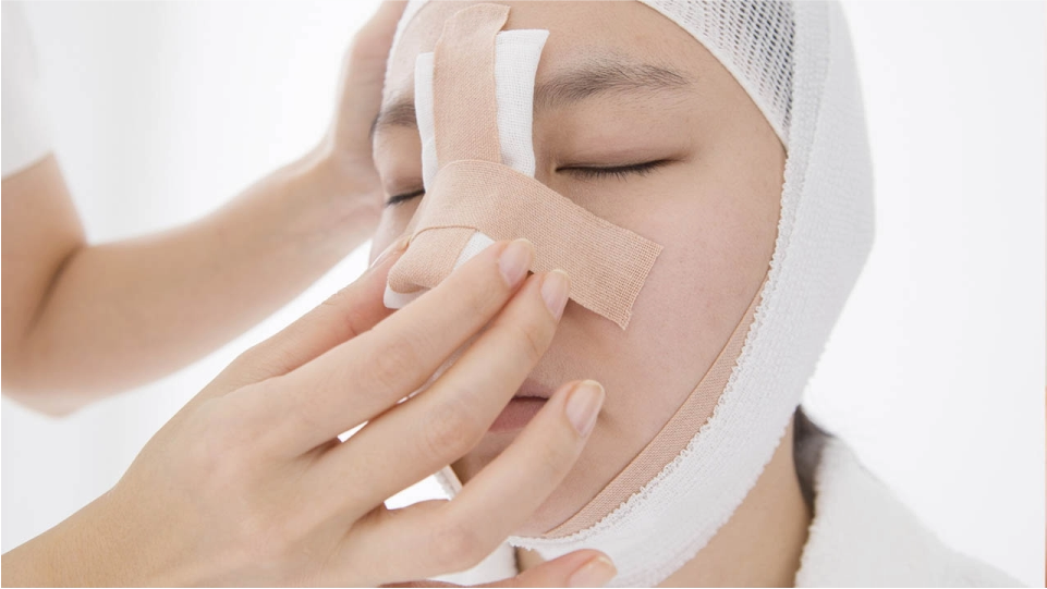 Reducción de fractura de hueso nasal