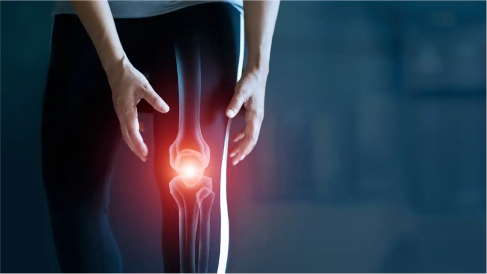 Osteoartritis