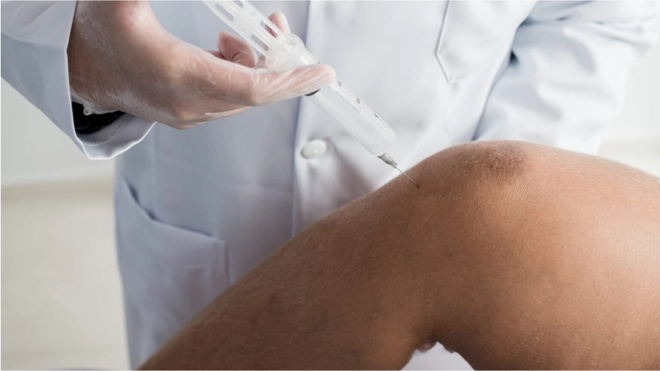 Viscosuplementación o infiltración articular con ácido hialurónico