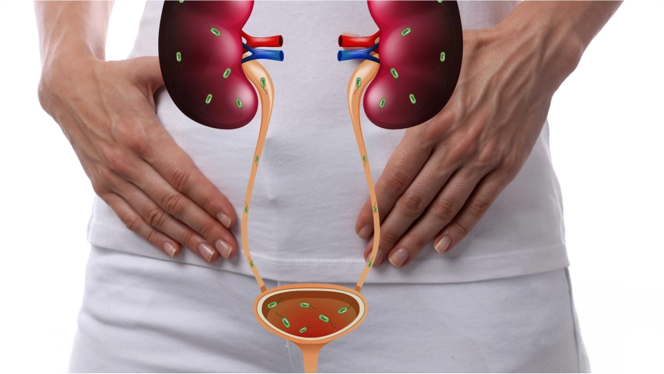 Infecciones urinarias ITU